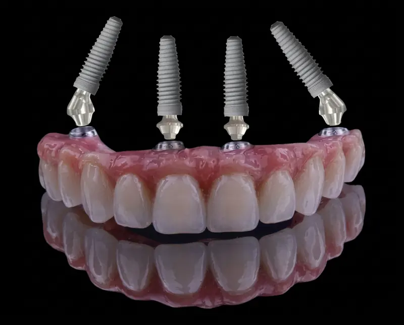 Implantes