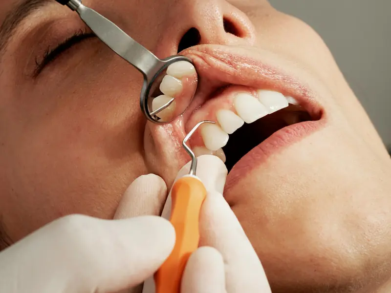 Limpeza e Prevenção