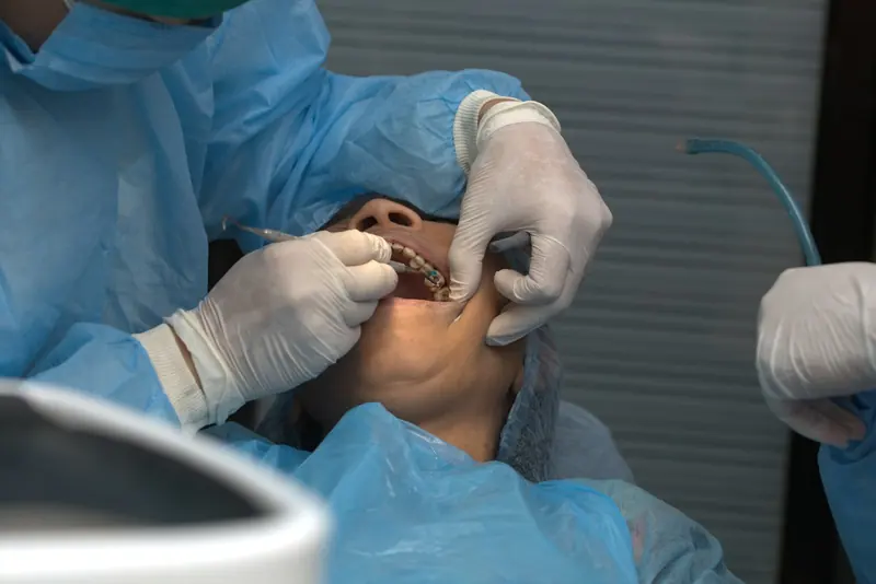 Cirurgia de Siso
